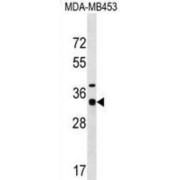 Myozenin 2 (MYOZ2) Antibody