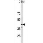 Glutaminyl-Peptide Cyclotransferase (QPCT) Antibody