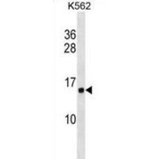 Histone Cluster 1, H2ab (HIST1H2AB) Antibody