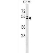 AP-4 Complex Subunit Mu-1 (AP4M1) Antibody