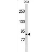 Zinc Finger Protein 7 (ZNF7) Antibody