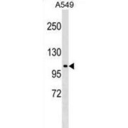 E3 Ubiquitin-Protein Ligase HECTD3 (HECTD3) Antibody