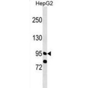 PPFIA Binding Protein 1 (PPFIBP1) Antibody