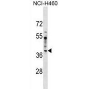 Serologically Defined Colon Cancer Antigen 8 (SDCCAG8) Antibody