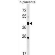 SPARC Related Modular Calcium Binding 2 (SMOC2) Antibody