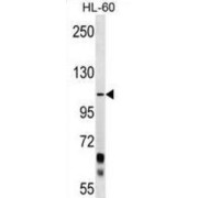 Protocadherin Alpha-10 (PCDHA10) Antibody