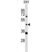 Zinc Finger Protein 2 (ZNF2) Antibody