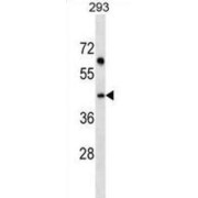 Stromal Cell Derived Factor 4 (SDF4) Antibody