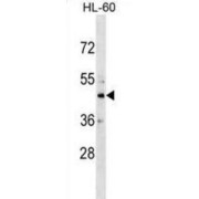 Carbohydrate Sulfotransferase 10 (CHST10) Antibody