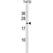 COMM Domain-Containing Protein 9 (COMMD9) Antibody