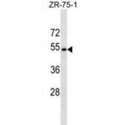 Coiled-Coil Domain Containing 112 (CCDC112) Antibody