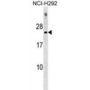 DnaJ Homolog Subfamily C Member 5G (DNAJC5G) Antibody