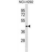 Zinc Finger Protein Neuro-D4 (DPF1) Antibody