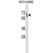 Cytochrome P450 Family 4 Subfamily V Member 2 (CYP4V2) Antibody