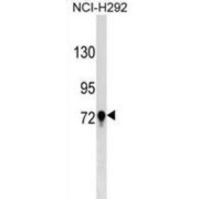 Transglutaminase 3, Epidermal (TGM3) Antibody