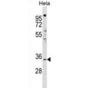 Imprinted And Ancient Gene Protein Homolog (IMPACT) Antibody