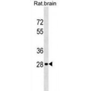 Homeobox Protein Hox-D9 (Rat Hoxd9) Antibody