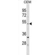 Ecotropic Viral Integration Site 2B (EVI2B) Antibody