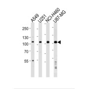 Zinc Finger Protein 41 (ZNF41) Antibody