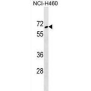 Zinc Finger Protein 83 (ZNF83) Antibody