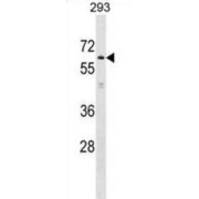 Kelch-Like Protein 2 (KLHL2) Antibody