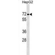 Protein Phosphatase 1 Regulatory Subunit 16B (PPP1R16B) Antibody