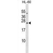 RAB20, Member RAS Oncogene Family (RAB20) Antibody