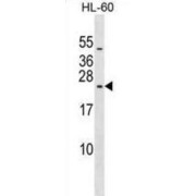 Ribosomal Protein L10 Like (RPL10L) Antibody