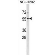 Zinc Finger Protein 200 (ZNF200) Antibody