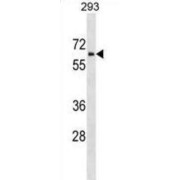 Zinc Finger HIT-Type Containing 6 (ZNHIT6) Antibody