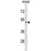 Cyclin Dependent Kinase Like 4 (CDKL4) Antibody