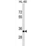 Era (E. Coli G-Protein Homolog)-Like 1 (ERAL1) Antibody