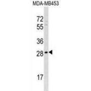 Axin Interactor, Dorsalization Associated (AIDA) Antibody