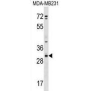 Cysteine Rich Secretory Protein 1 (CRISP1) Antibody