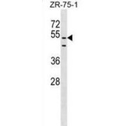 PDZ Domain Containing 3 (PDZD3) Antibody