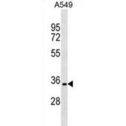 Parkin Coregulated Gene Protein (PACRG) Antibody