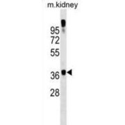 General Transcription Factor IIA, Polypeptide 1 (GTF2A1) Antibody