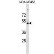 Serpin I2 (SERPINI2) Antibody