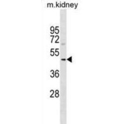 SDS3 Homolog, SIN3A Corepressor Complex Component (SUDS3) Antibody