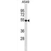 mRNA Decay Activator Protein ZFP36L2 (ZFP36L2) Antibody