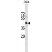 Zinc Finger Protein 331 (ZNF331) Antibody