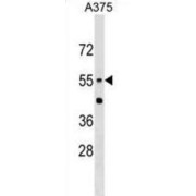 Beta-Ala-His Dipeptidase (CNDP1) Antibody