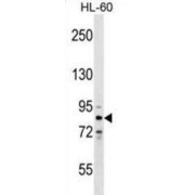 Zinc Finger Protein 224 (ZNF224) Antibody