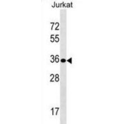 Uroplakin-3b (UPK3B) Antibody