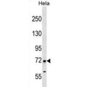 Fidgetin Like 1 (FIGNL1) Antibody