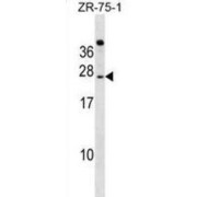 Immunoglobulin Superfamily Member 6 (IGSF6) Antibody