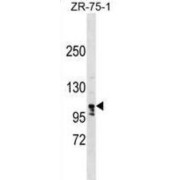 La Ribonucleoprotein Domain Family Member 1B (LARP1B) Antibody