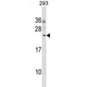 Motile Sperm Domain Containing 3 (MOSPD3) Antibody