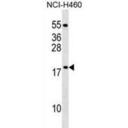 Mitochondrial Ribosomal Protein L54 (MRPL54) Antibody