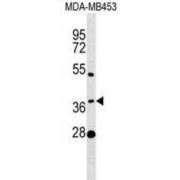 Methenyltetrahydrofolate Synthetase Domain Containing (MTHFSD) Antibody